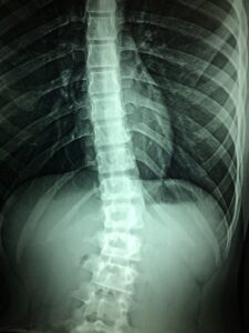 x-rays, hospital, disability