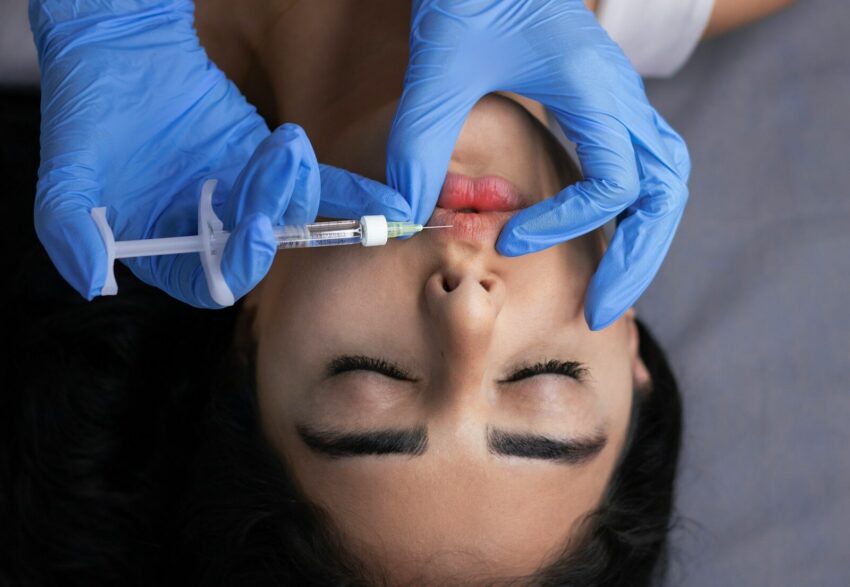 Lips receive an injection of filler
